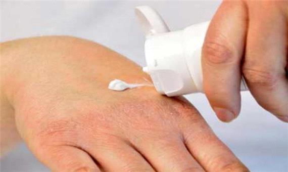 درمان های خانگی رفع ترک دست ها در زمستان