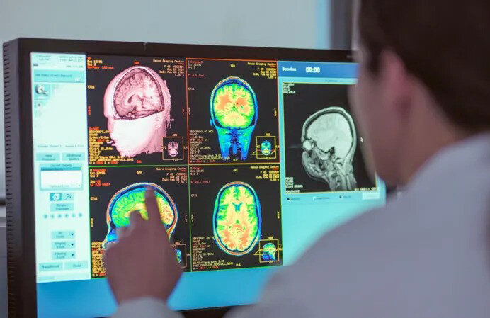 مغزتان تا ۳۰ سالگی هم می‌تواند نوجوان باشد!