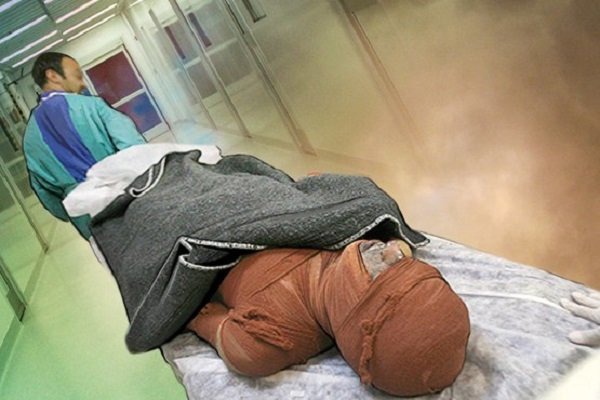 مرگ‌ومیر ناشی از سوختگی در آذربایجان‌شرقی ۳۳ درصد افزایش یافت